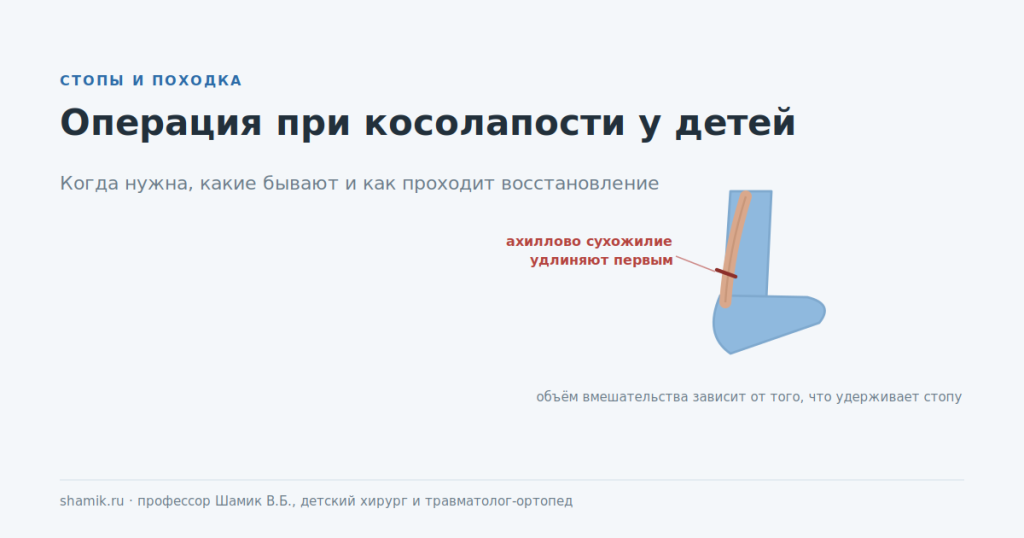 Операция при косолапости у детей: ахиллово сухожилие удлиняют первым