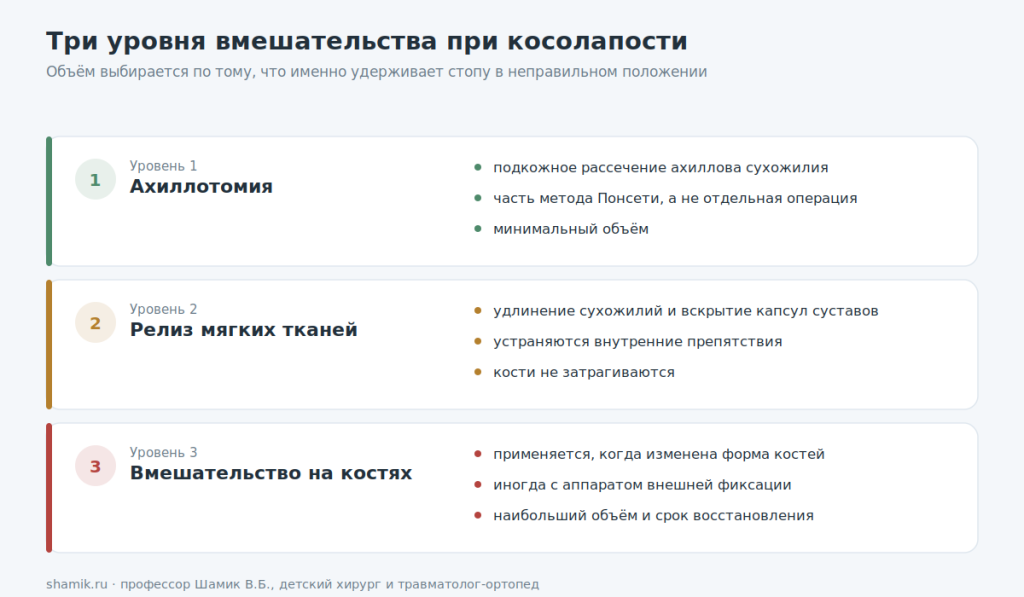 Три уровня вмешательства при косолапости: ахиллотомия, релиз мягких тканей, операции на костях