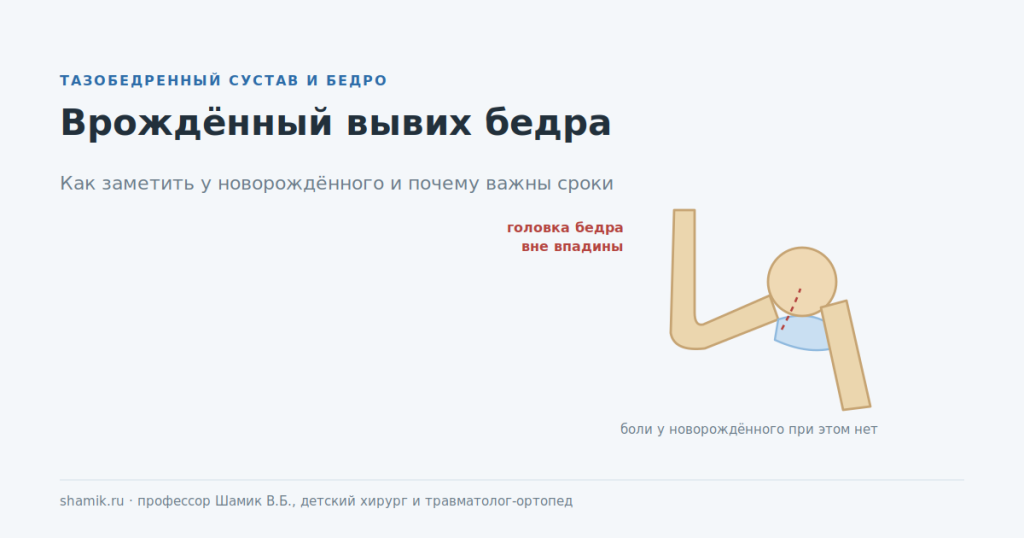 Врождённый вывих бедра: головка бедренной кости вне вертлужной впадины