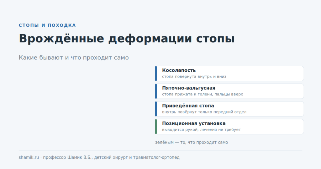 Врождённые деформации стопы у новорождённых: основные виды