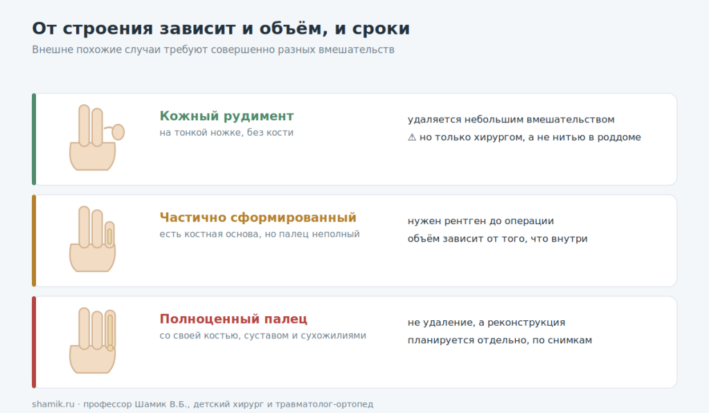 Типы полидактилии: кожный рудимент, частично сформированный и полноценный палец
