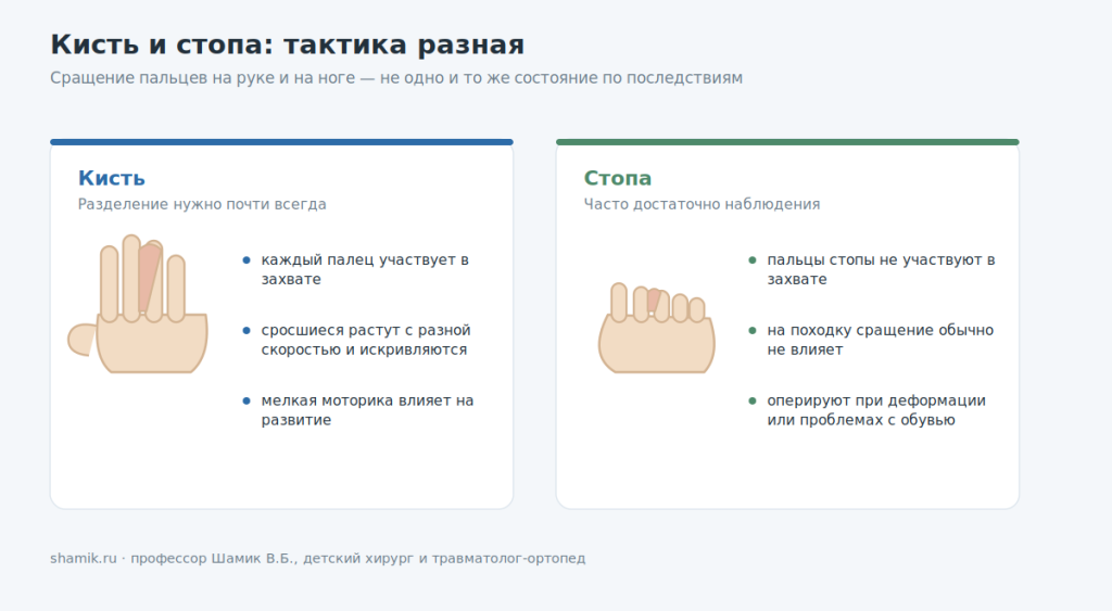 Синдактилия кисти и стопы: разная тактика лечения