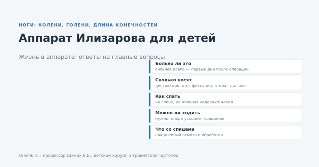 Аппарат Илизарова для детей: ответы на главные вопросы о жизни в аппарате