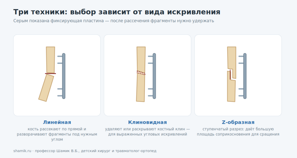 Три техники корригирующей остеотомии: линейная, клиновидная, Z-образная