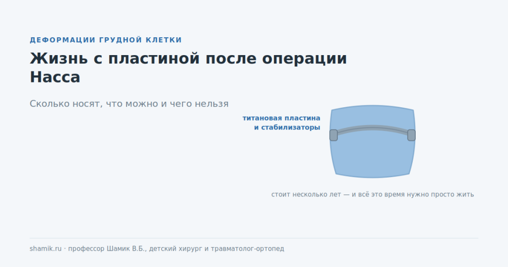Пластина и стабилизаторы в грудной клетке после операции Насса