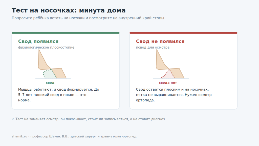 Тест на носочках: как отличить физиологическое плоскостопие от плоско-вальгусной деформации