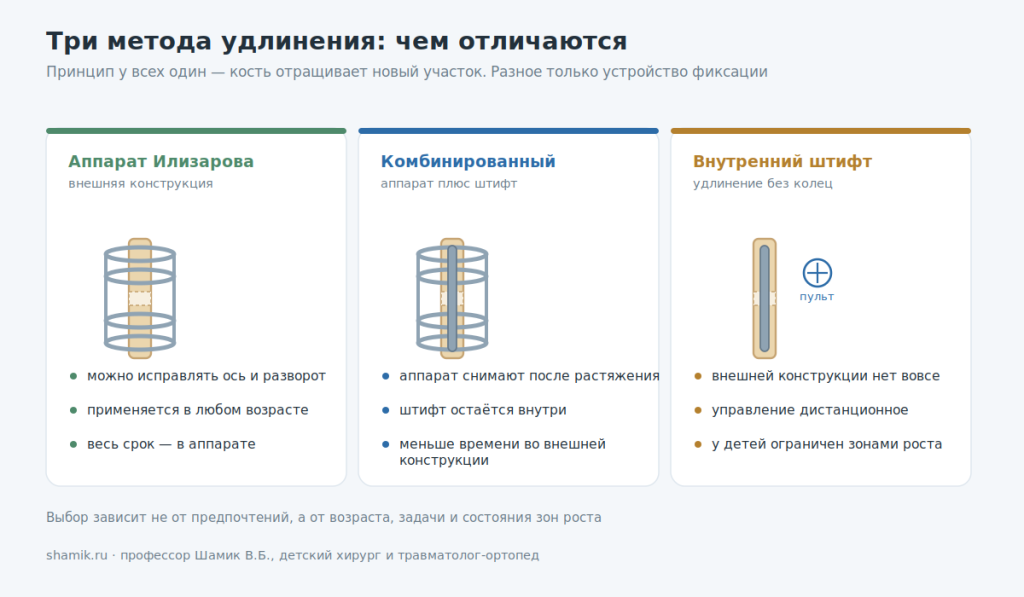 Сравнение методов удлинения конечностей: аппарат Илизарова, комбинированный, внутренний штифт