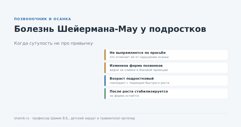 Болезнь Шейермана-Мау у подростков: чем стойкая сутулость отличается от привычной