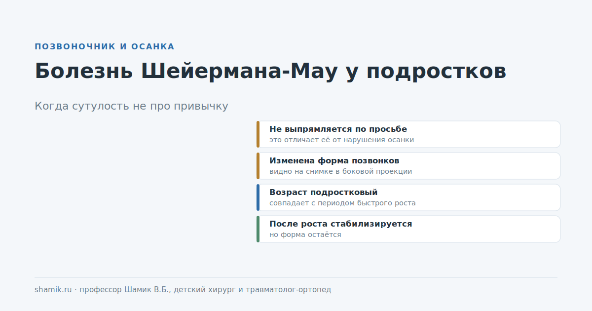 Болезнь Шейермана-Мау у подростков: чем стойкая сутулость отличается от привычной