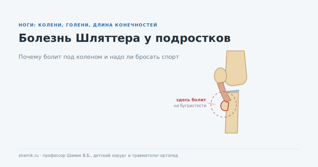 Болезнь Шляттера у подростков: боль на бугристости большеберцовой кости под коленом