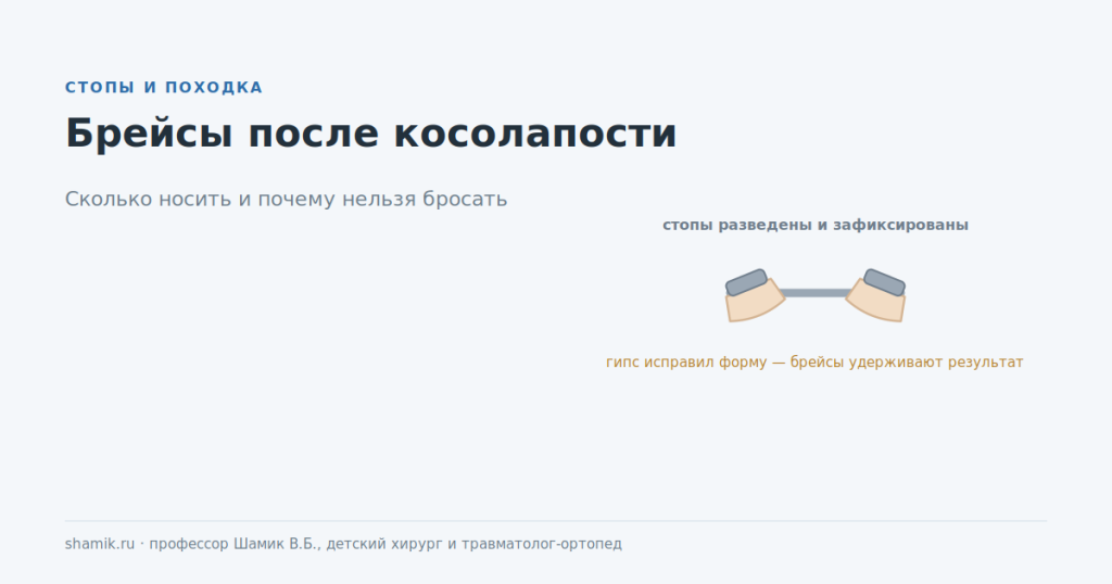Брейсы после лечения косолапости: стопы разведены и зафиксированы