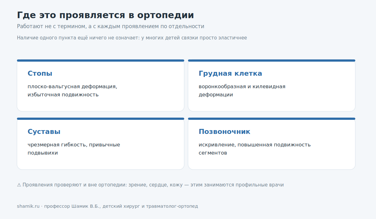 Ортопедические проявления дисплазии соединительной ткани: стопы, грудная клетка, суставы, позвоночник