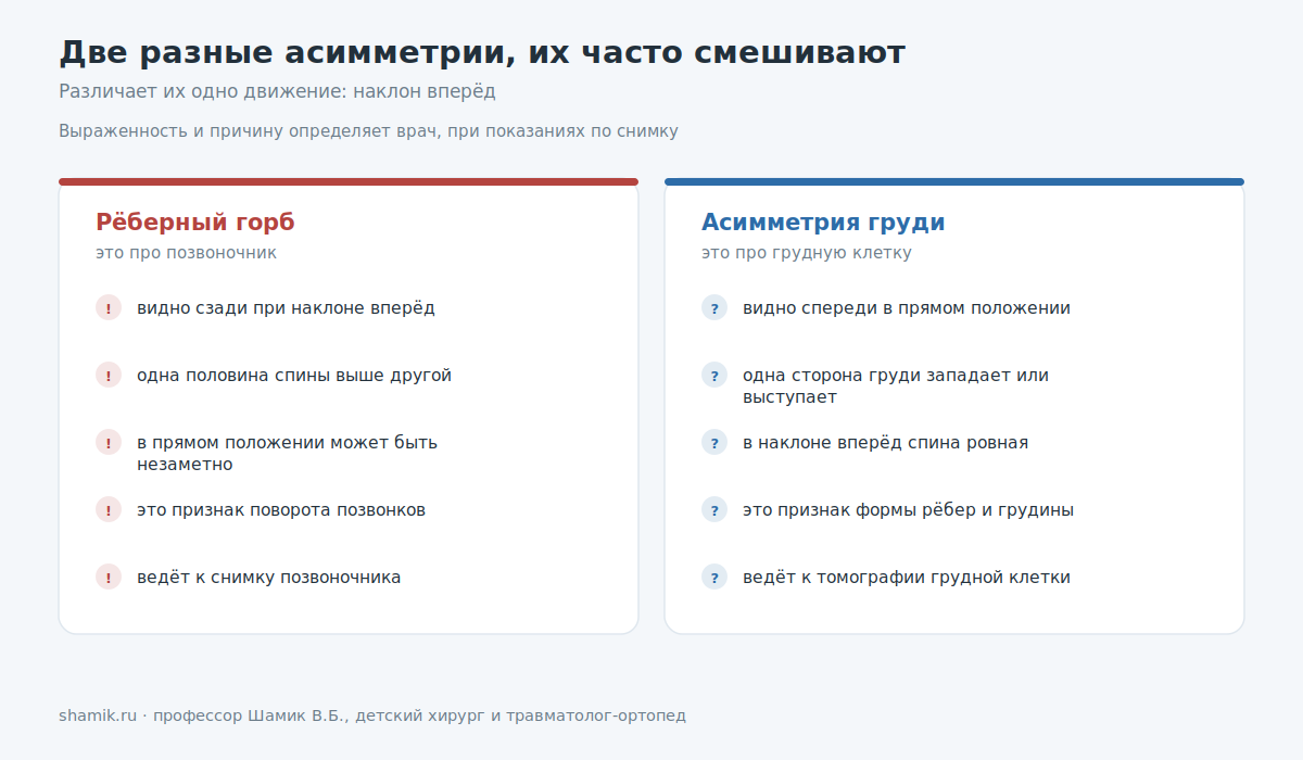 Чем рёберный горб отличается от асимметрии грудной клетки