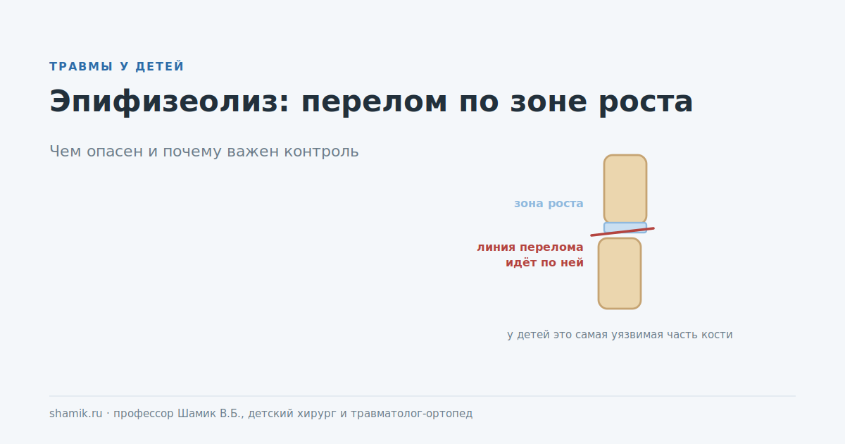 Эпифизеолиз у ребёнка: линия перелома проходит по зоне роста кости