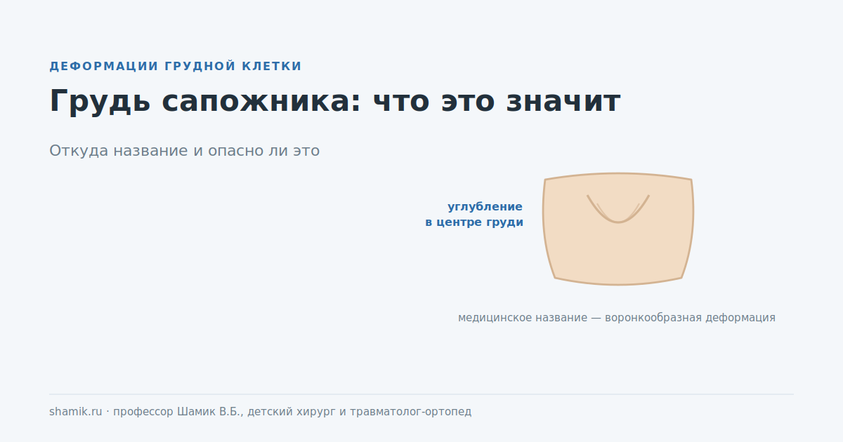 Грудь сапожника: углубление в центре грудной клетки, медицинское название — воронкообразная деформация