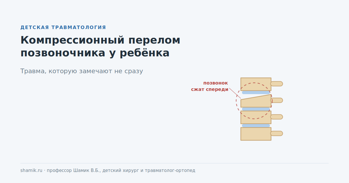 Компрессионный перелом позвоночника у ребёнка: позвонок сжат спереди и стал клиновидным