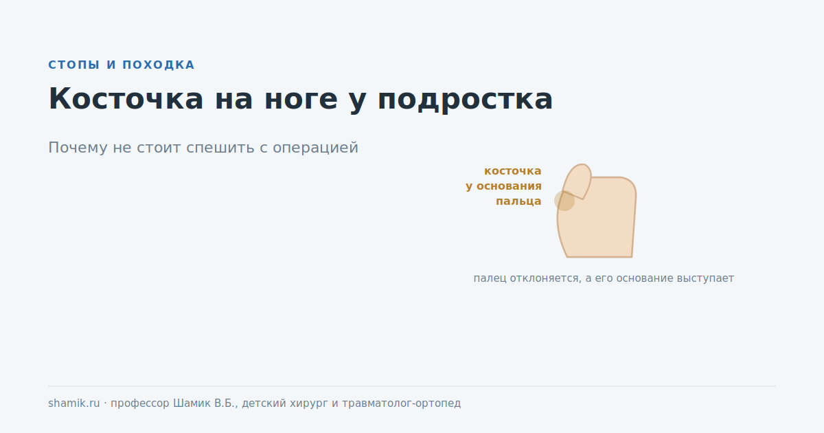 Косточка на ноге у подростка: большой палец отклонён, его основание выступает