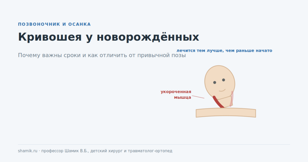 Кривошея у новорождённых: голова наклонена в сторону укороченной мышцы шеи