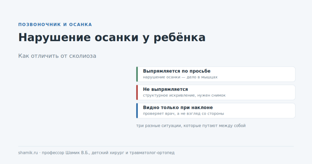 Нарушение осанки у ребёнка: чем отличается от структурного искривления позвоночника