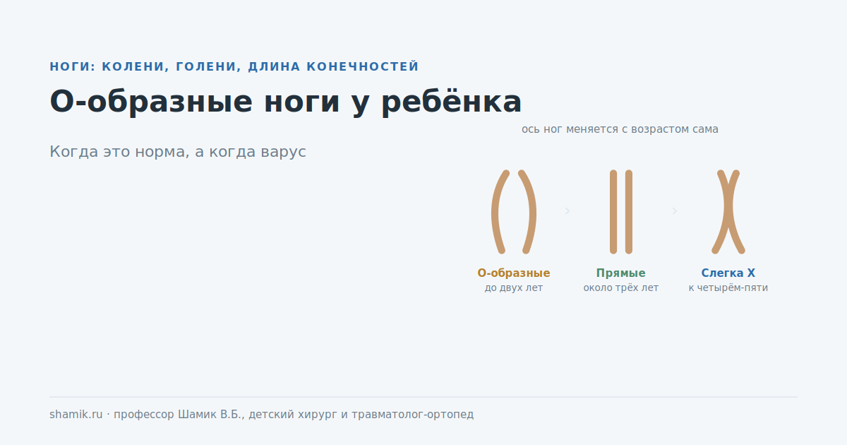 О-образные ноги у ребёнка: как ось ног меняется с возрастом