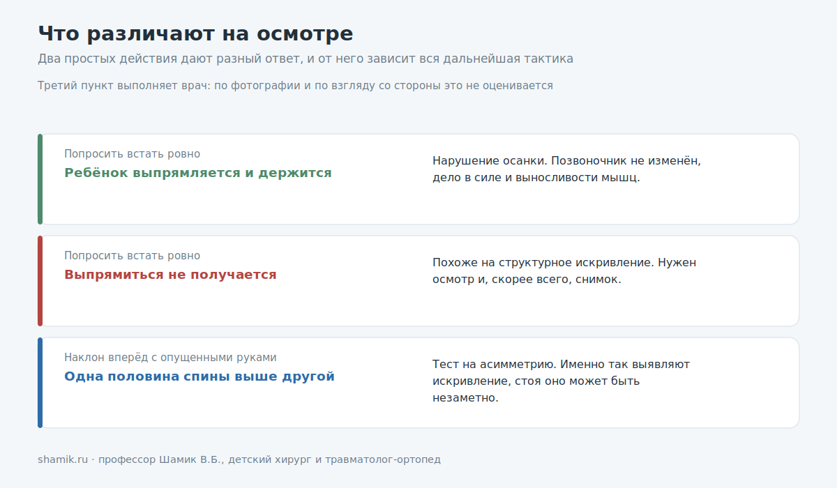 Как на осмотре различают нарушение осанки и структурное искривление позвоночника