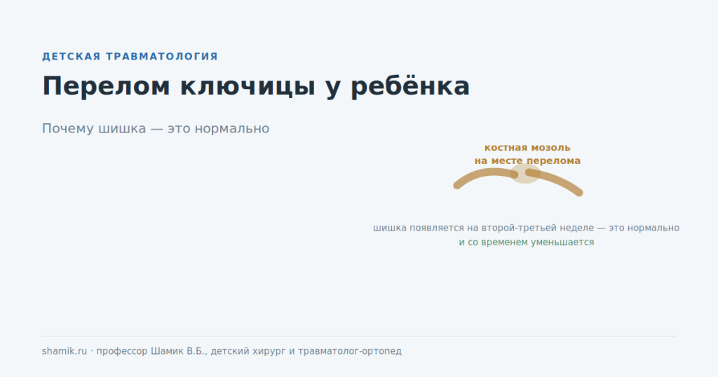 Перелом ключицы у ребёнка: костная мозоль на месте перелома выглядит как шишка