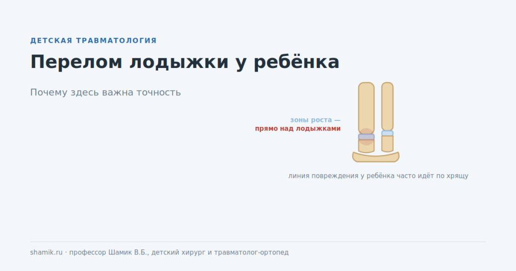Перелом лодыжки у ребёнка: зоны роста расположены прямо над лодыжками