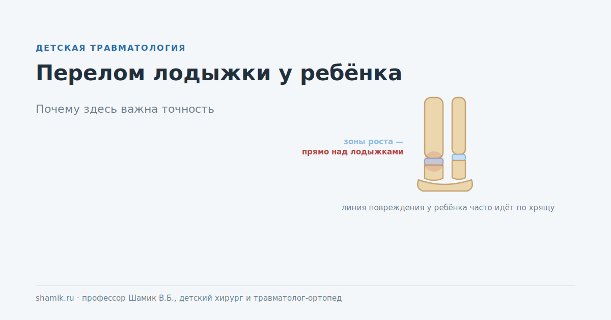 Перелом лодыжки у ребёнка: зоны роста расположены прямо над лодыжками