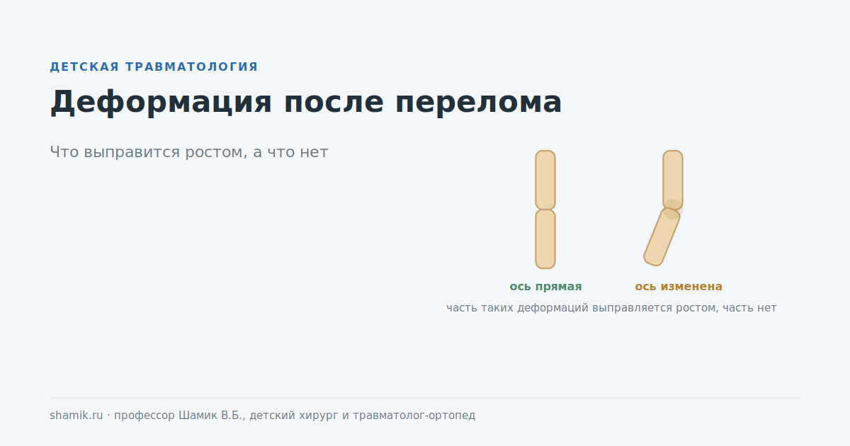 Деформация после перелома у ребёнка: ось конечности изменена