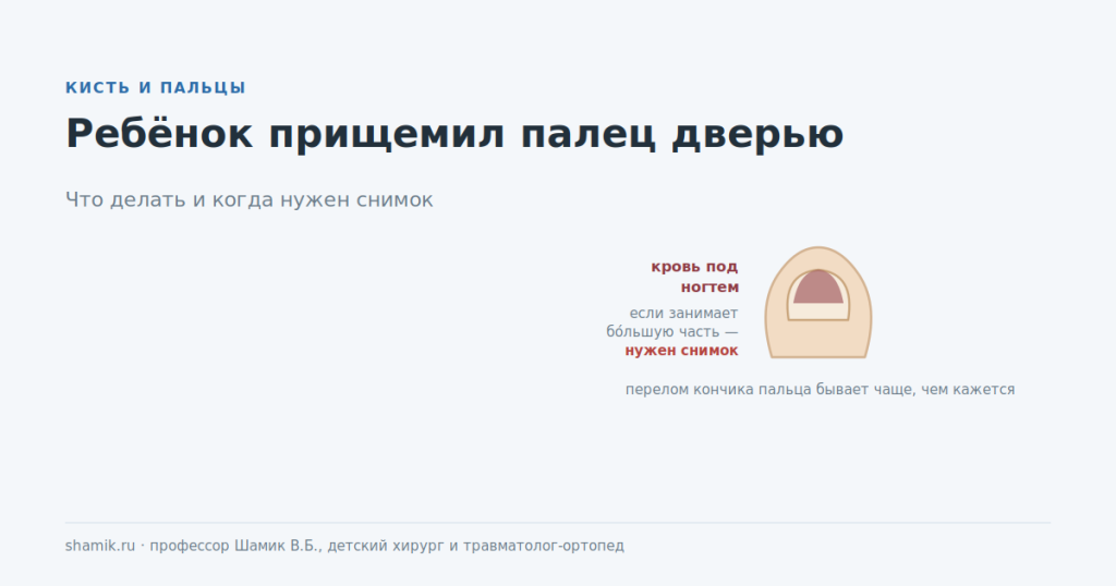 Ребёнок прищемил палец дверью: кровь под ногтем и признаки, при которых нужен снимок