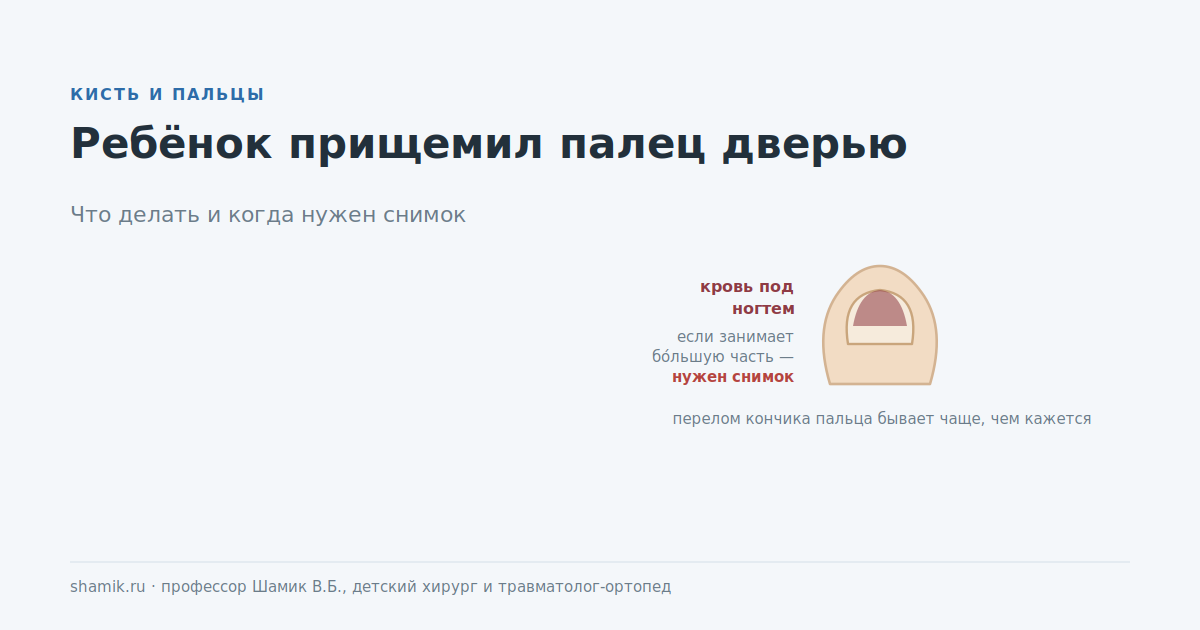 Ребёнок прищемил палец дверью: кровь под ногтем и признаки, при которых нужен снимок