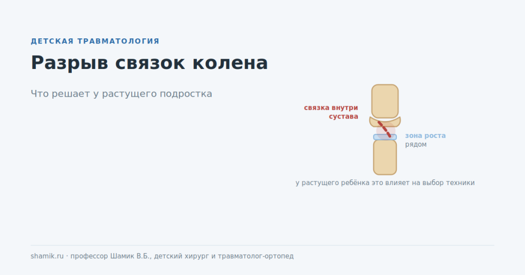 Разрыв связок коленного сустава у подростка: связка внутри сустава рядом с зоной роста