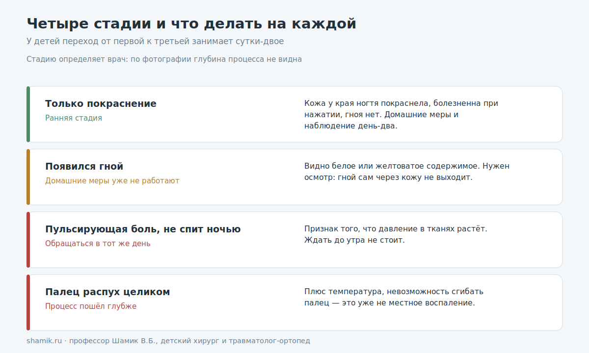 Четыре стадии нарыва на пальце у ребёнка и что делать на каждой