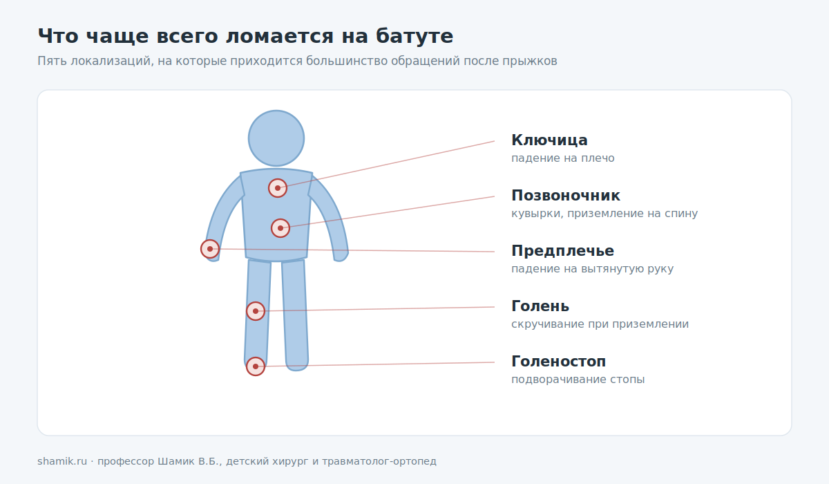 Карта травм на батуте у детей: ключица, позвоночник, предплечье, голень, голеностоп