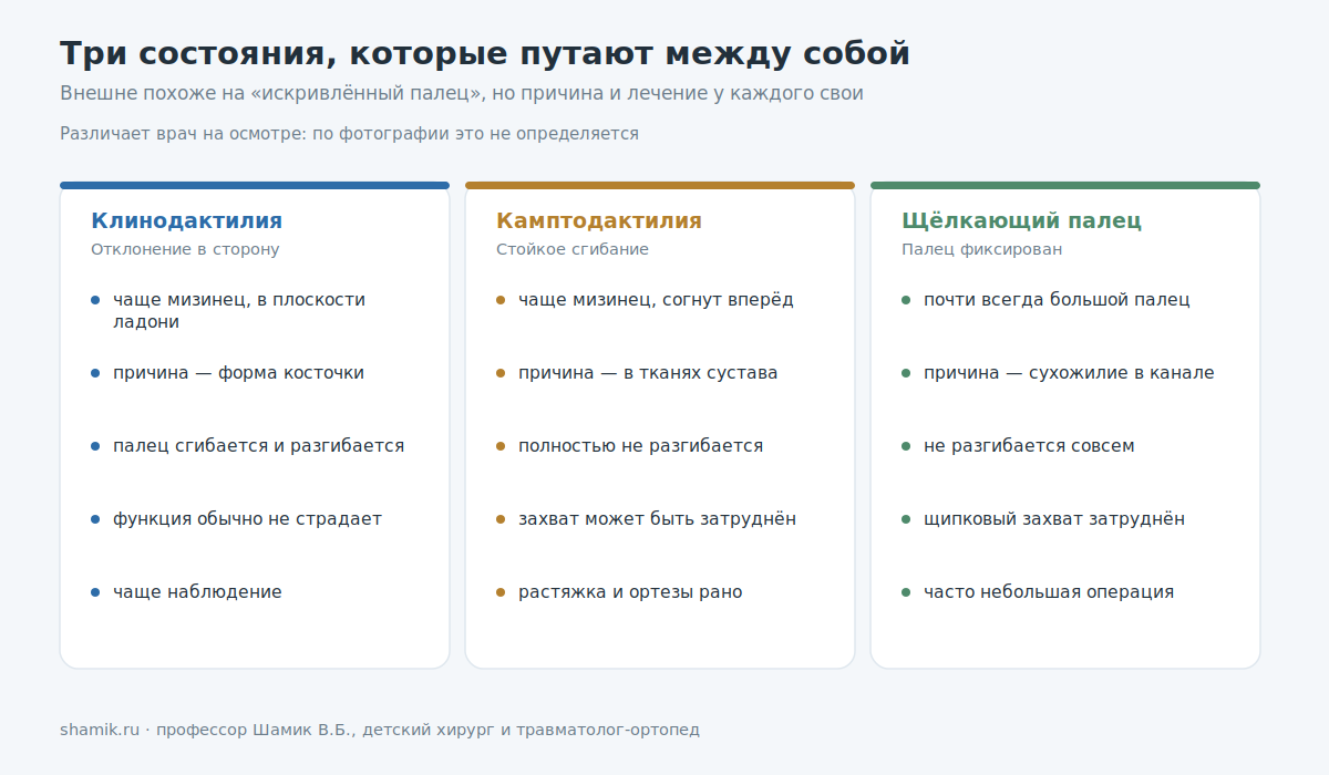 Сравнение клинодактилии, камптодактилии и щёлкающего пальца у ребёнка