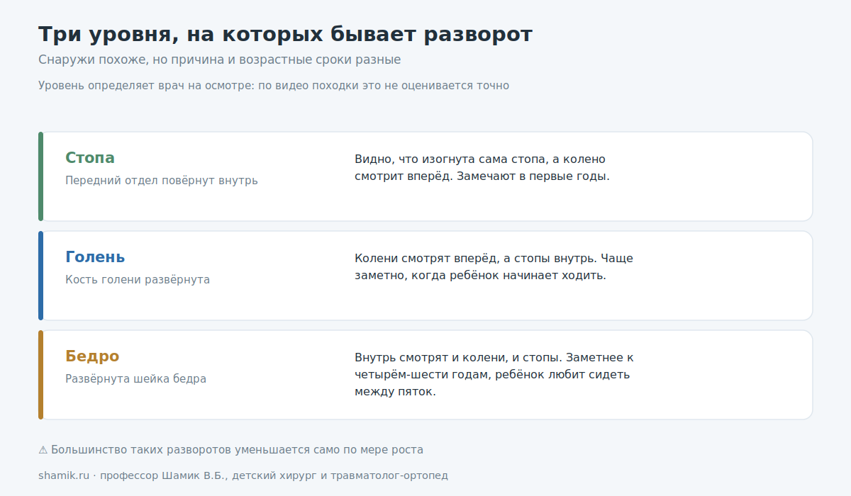 Три уровня разворота при походке носками внутрь: стопа, голень, бедро