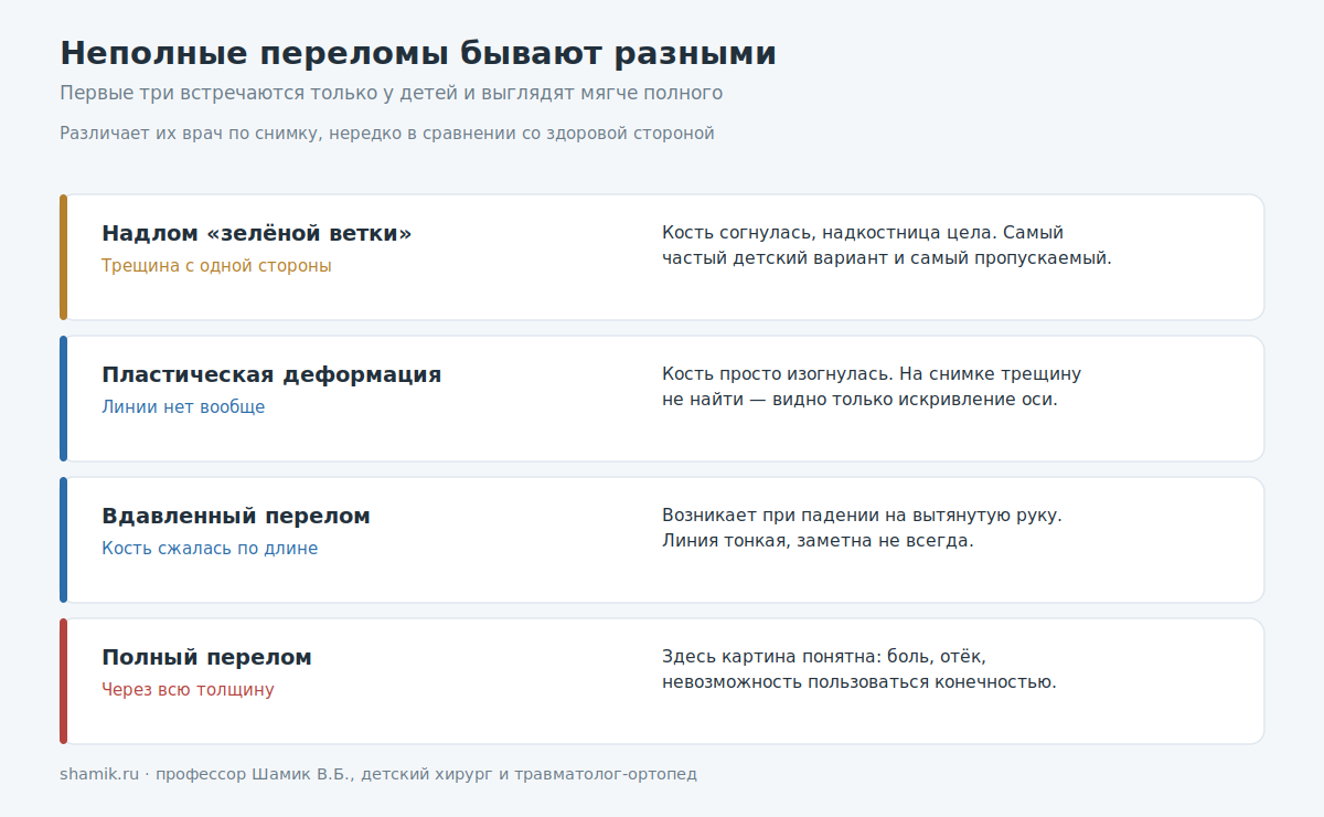 Виды неполных переломов у детей: зелёная ветка, пластическая деформация, вдавленный
