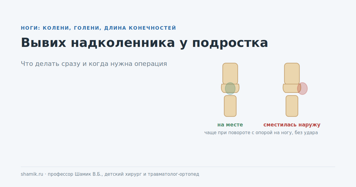 Вывих надколенника у подростка: коленная чашечка сместилась наружу