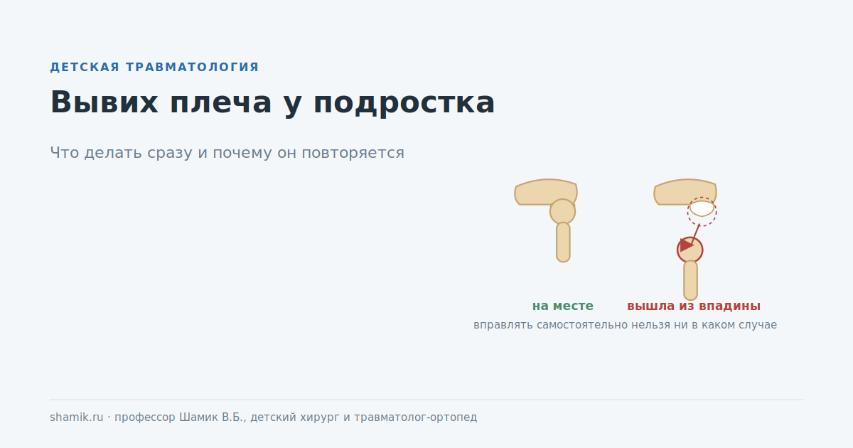Вывих плеча у подростка: головка вышла из суставной впадины