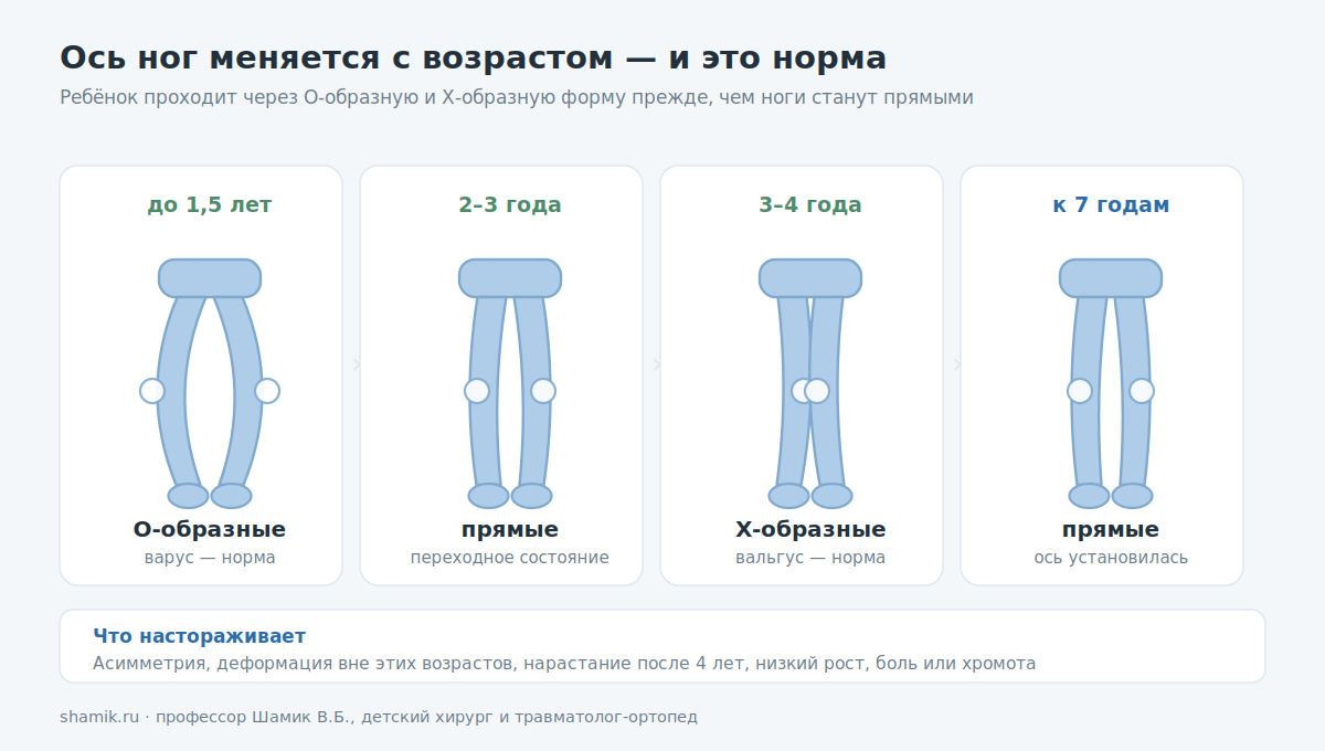 Как меняется ось ног у ребёнка с возрастом: О-образные, прямые, Х-образные, прямые